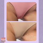 SoftDrop™ Post-Depilación y Aclarante