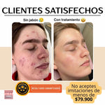 JABÓN CÚRCUMA CúrcuSkin™ Natural Care