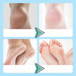 SERUM HIDRATANTE PARA PIES AGRIETADOS Vasylk™