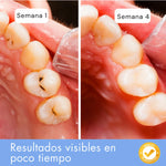 Noroos Dentite® – Suero Bucal Re-mineralizante con Nano-Hidroxiapatita